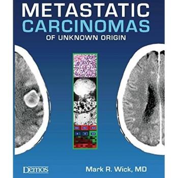 Metastatic Carcinomas of Unknown Origin