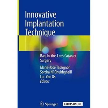 Innovative Implantation Technique: Bag-in-the-Lens Cataract Surgery