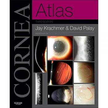 Cornea Atlas: Expert Consult - Online and Print, 3e