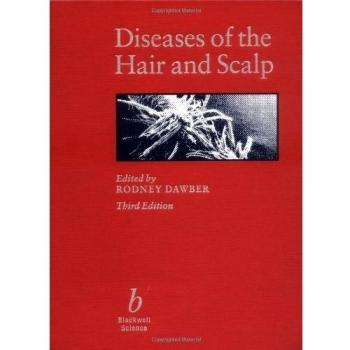 Diseases of the Hair and Scalp