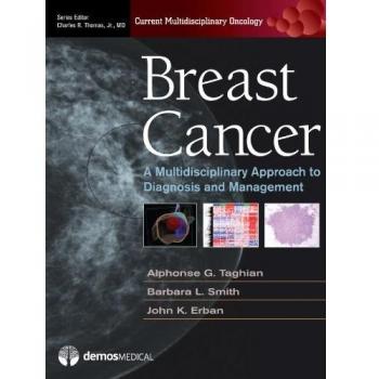 Springer Publishing Co. Breast Cancer: Current Multidisciplinary Oncology Series Guide