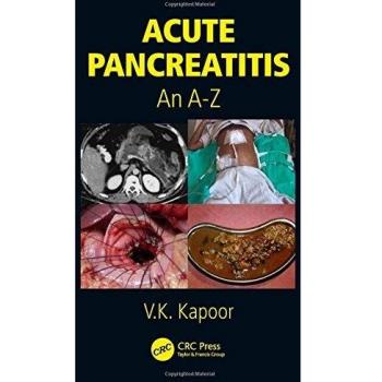 Acute Pancreatitis: An A-Z