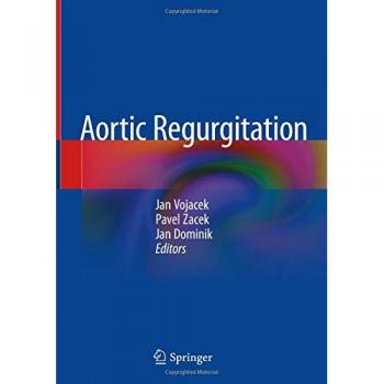 Aortic Regurgitation