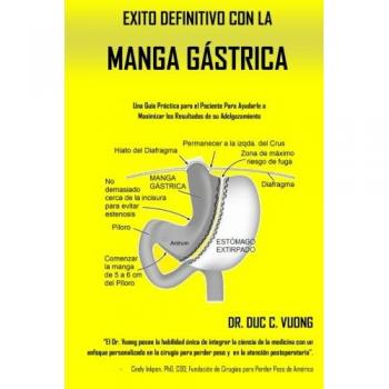 Exito Definitivo con la Manga Gástrica: Una Guía Práctica para el Paciente para Ayudarle a Maximizar su Adelgazamiento