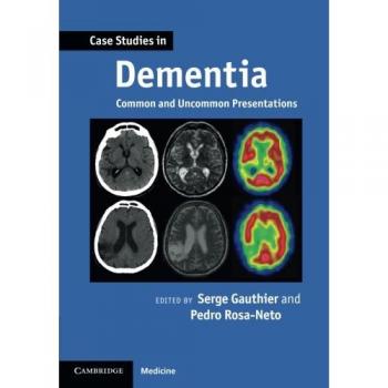 Estudios de Caso en Demencia: Presentaciones Comunes y Poco Comunes (Estudios de Caso en Neurología)