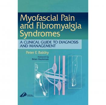 Myofascial Pain and Fibromyalgia Syndromes: A Clinical Guide to Diagnosis and Management, 1e