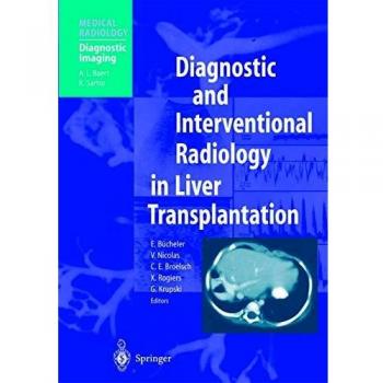 Diagnostic and Interventional Radiology in Liver Transplantation