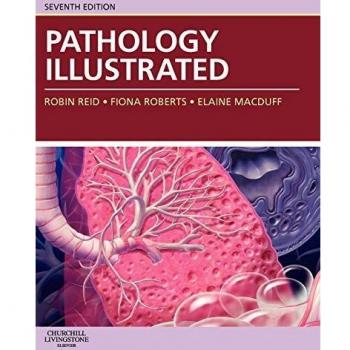 Pathology Illustrated