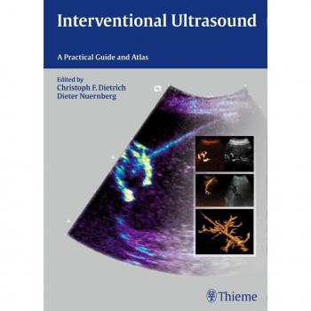 Interventional Ultrasound: A Practical Guide and Atlas