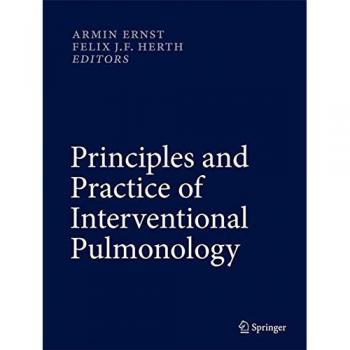 Interventional Pulmonology: Comprehensive Guide and Clinical Practice