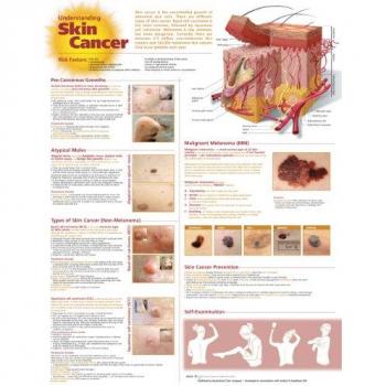 Tabla anatómica para el cáncer de piel