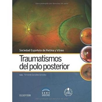 Traumatismos Del Polo Posterior + Acceso Web