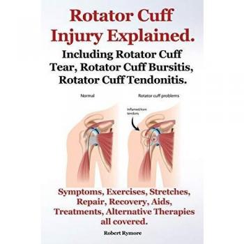 Rotator Cuff Injury Explained. Including Rotator Cuff Tear, Rotator Cuff Bursitis, Rotator Cuff Tendonitis. Symptoms, Exercises, Stretches, Repair, Re