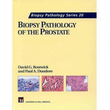 Biopsy Pathology of the Prostate