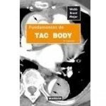 TAC Body
