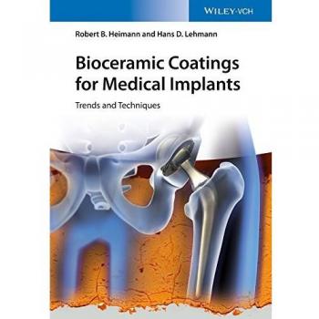 Bioceramic Coatings for Medical Implants: Trends and Techniques