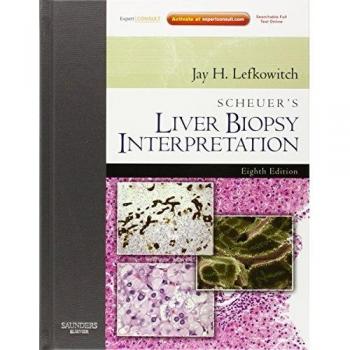 Scheuer's Liver Biopsy Interpretation: Expert Consult: Online and Print, 8e