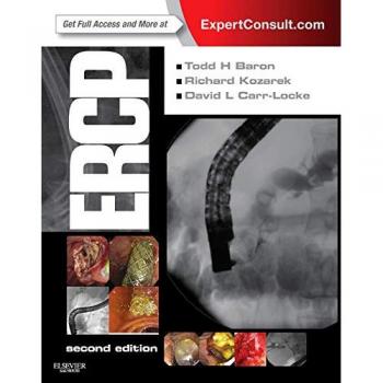 ERCP, 2e