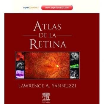 Atlas de la retina