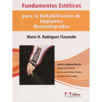 Fundamentos estéticos para La Rehabilitación de implantes Oseointegrados