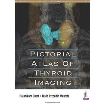 Pictorial Atlas of Thyroid Imaging