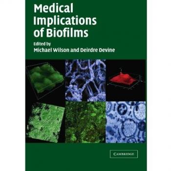 Implicaciones Médicas de los Biofilms - Edición en Rústica Cambridge