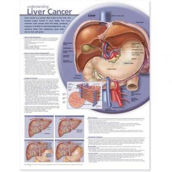 Understanding Liver Cancer Anatomical Chart