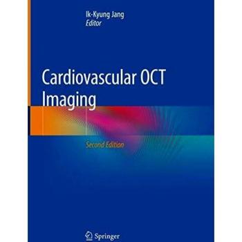 Cardiovascular OCT Imaging