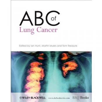 ABC of Lung Cancer
