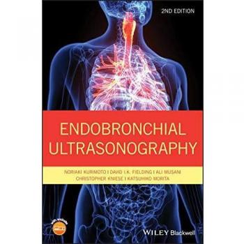 Endobronchial Ultrasonography