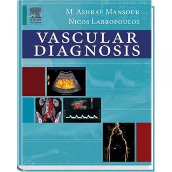 Vascular Diagnosis