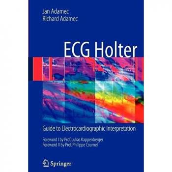 ECG Holter: Guide to Electrocardiographic Interpretation