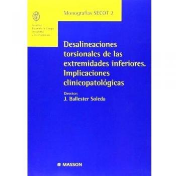 Desalineaciones torsionales de las extremidades inferiores