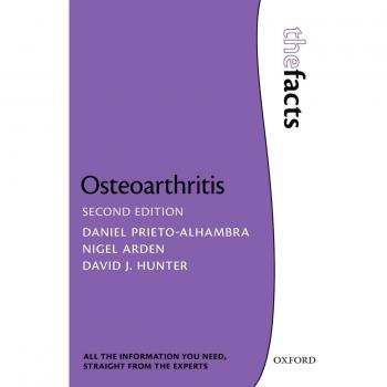 Osteoarthritis the facts the facts series