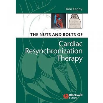 The Nuts and Bolts of Cardiac Resynchronization Therapy: 2