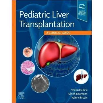 Pediatric Liver Transplantation Guide, 1st Edition