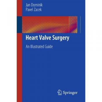 Heart Valve Surgery: An Illustrated Guide