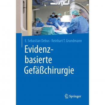 Evidenzbasierte Gefäßchirurgie