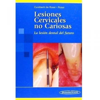 Lesiones cervicales no cariosas: La lesión dental del futuro