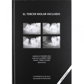 El tercer molar incluido: 83