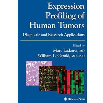 Expression Profiling of Human Tumors: Diagnostic and Research Applications