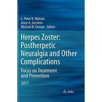 Herpes Zoster: Postherpetic Neuralgia and Other Complications: Focus on Treatment and Prevention