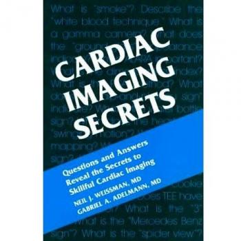 Cardiac Imaging Secrets, 1e