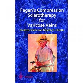 Fegan’s Compression Sclerotherapy for Varicose Veins