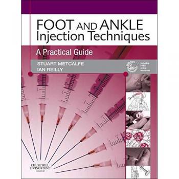 Foot and Ankle Injection Techniques: A Practical Guide, 1e