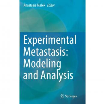 Experimental Metastasis: Modeling and Analysis