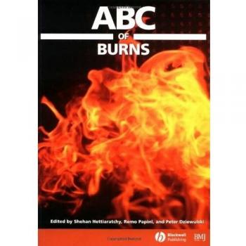 ABC of Burns