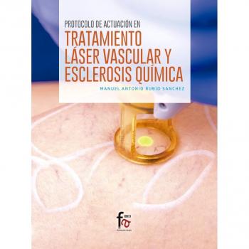 Protocolo de Actuación en El Tratamiento Láser Vascular y Esclerosis Química