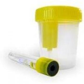 KIT ACOFAR ENVASE ORINA 120+TUBO VACIO
