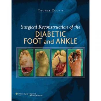 Surgical Reconstruction of the Diabetic Foot and Ankle